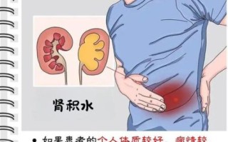 孕妇肾积水是什么原因引起的_孕妇肾积水对胎儿有影响吗