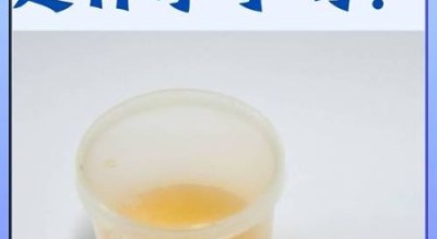 孕妇尿黄正常吗_孕早期尿黄是什么原因