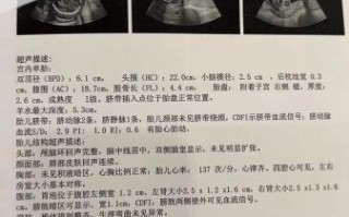 孕妇心脏彩超几周做最合适_心脏彩超最佳孕周