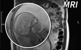 孕妇可以做核磁共振吗_对胎儿有影响吗