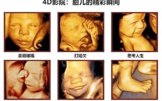 孕妇四维彩超最佳时间_几周做最合适