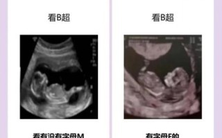 孕妇初乳早怀的是男孩吗_初乳早与胎儿性别关系