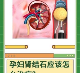 孕妇结石怎么办_孕妇结石对胎儿有影响吗