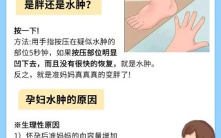 孕妇手水肿怎么缓解_孕妇手水肿正常吗