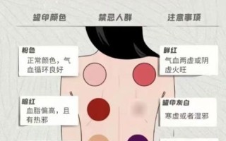 孕妇可以拔罐吗_孕期拔罐安全指南