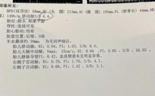 孕妇sd值正常范围_脐动脉sd偏高怎么办