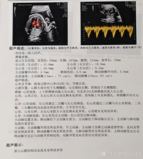 孕妇心脏彩超几周做最合适_心脏彩超最佳孕周-第3张图片-星辰妙记 孕妇心脏彩超几周做最合适_心脏彩超最佳孕周-第3张图片-星辰妙记