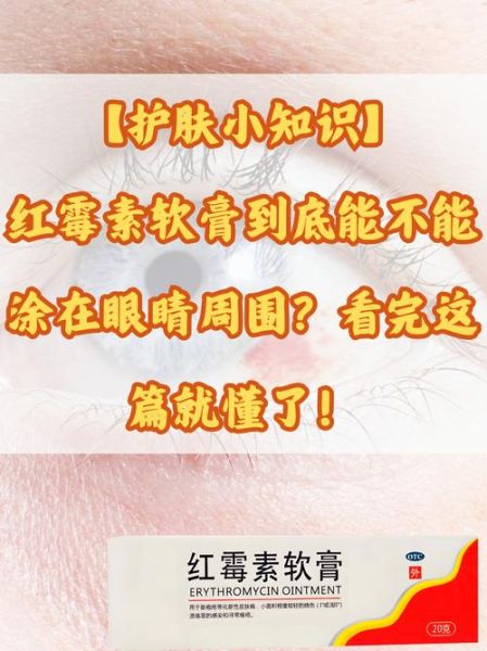 孕妇能用红霉素眼膏吗_孕期红霉素眼膏安全吗-第1张图片-星辰妙记