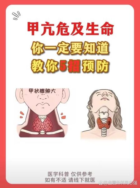 孕妇甲亢会影响胎儿吗_甲亢怀孕对胎儿有什么危害-第2张图片-星辰妙记