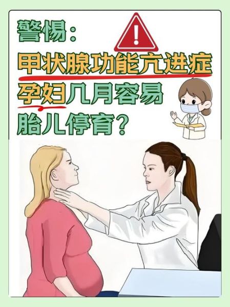 孕妇甲亢会影响胎儿吗_甲亢怀孕对胎儿有什么危害-第1张图片-星辰妙记