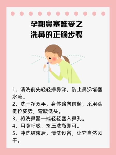 孕妇鼻塞怎么缓解_孕期鼻塞安全方法-第3张图片-星辰妙记
