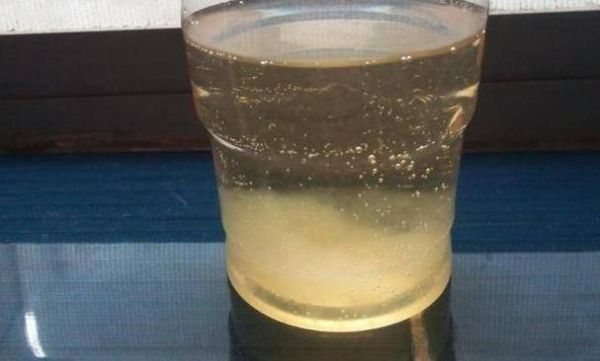 孕妇尿液味道很重_正常吗-第3张图片-星辰妙记