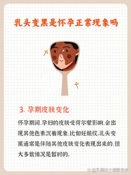 孕妇乳头变黑正常吗_孕妇乳头护理方法-第2张图片-星辰妙记