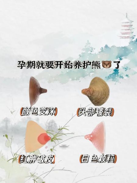 孕妇乳头变黑正常吗_孕妇乳头护理方法-第3张图片-星辰妙记