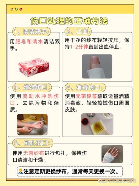 孕妇可以擦酒精吗_孕妇用酒精消毒安全吗-第2张图片-星辰妙记