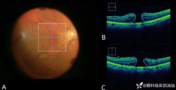 孕妇做OCT多少钱_OCT检查费用明细-第3张图片-星辰妙记