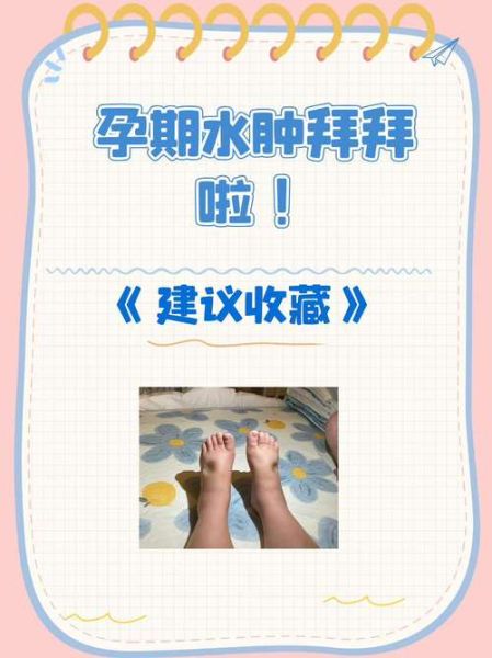 孕妇三肿三消是什么意思_孕晚期水肿怎么缓解-第1张图片-星辰妙记