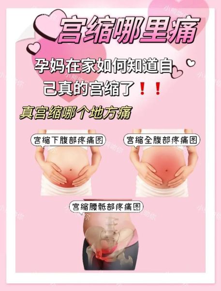 孕妇肚子一阵一阵疼是怎么回事_临产宫缩还是假性宫缩-第2张图片-星辰妙记 孕妇肚子一阵一阵疼是怎么回事_临产宫缩还是假性宫缩-第2张图片-星辰妙记