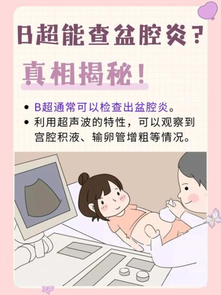 孕妇内检是怎么检查_内检会不会很疼-第1张图片-星辰妙记