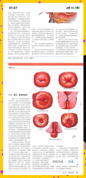 孕妇内检是怎么检查_内检会不会很疼-第2张图片-星辰妙记