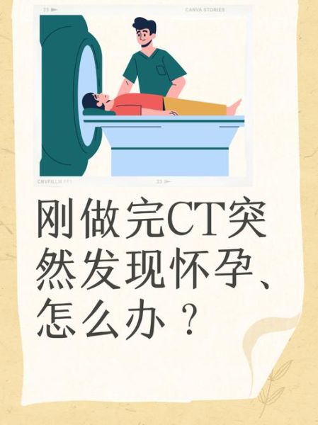 孕妇可以做ct检查吗_ct对胎儿有影响吗-第1张图片-星辰妙记