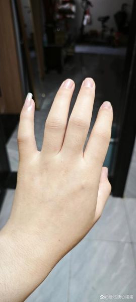 孕妇手肿是什么原因_孕晚期手指肿胀怎么缓解-第3张图片-星辰妙记