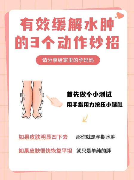 孕妇几个月开始水肿_如何缓解孕期水肿-第1张图片-星辰妙记