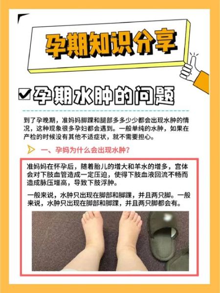 孕妇几个月开始水肿_如何缓解孕期水肿-第2张图片-星辰妙记