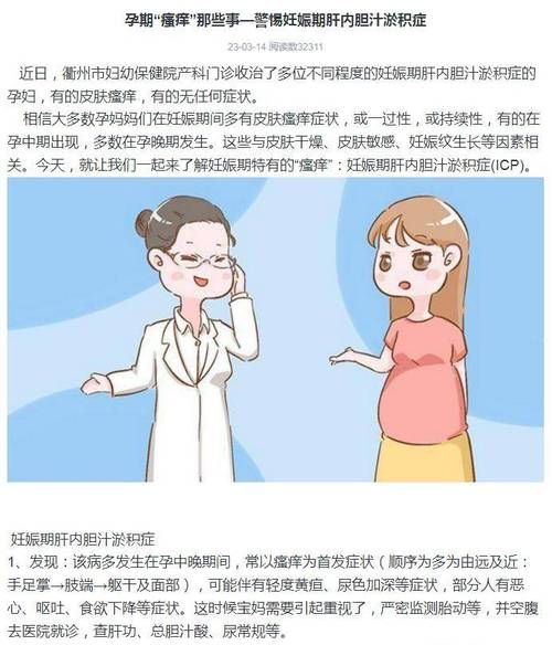 孕妇胆汁淤积能治好吗_对胎儿影响大吗-第2张图片-星辰妙记