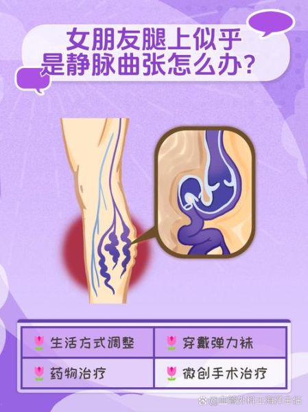 孕妇大腿有紫色血丝怎么办_怀孕静脉曲张怎么缓解-第1张图片-星辰妙记 孕妇大腿有紫色血丝怎么办_怀孕静脉曲张怎么缓解-第1张图片-星辰妙记