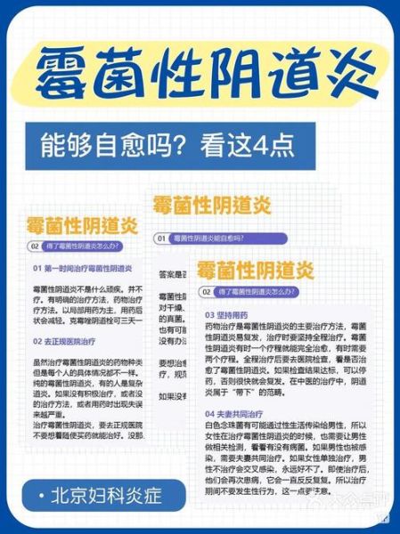 孕妇念珠菌能自愈吗_孕期霉菌感染怎么办-第1张图片-星辰妙记