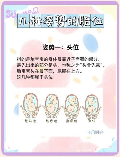 孕妇几个月定胎位_胎位什么时候固定-第3张图片-星辰妙记