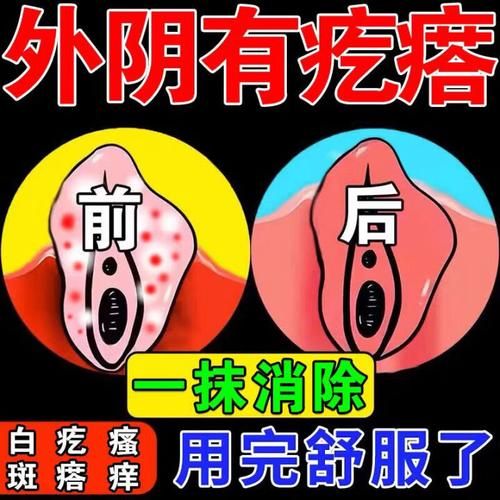孕妇下面痒怎么办_孕妇外阴瘙痒用什么药-第1张图片-星辰妙记 孕妇下面痒怎么办_孕妇外阴瘙痒用什么药-第1张图片-星辰妙记