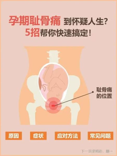 孕妇大腿根疼怎么回事_怎么缓解-第1张图片-星辰妙记