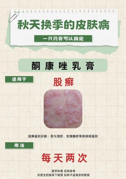 孕妇能用什么药膏_孕妇湿疹用什么药膏安全-第3张图片-星辰妙记 孕妇能用什么药膏_孕妇湿疹用什么药膏安全-第3张图片-星辰妙记