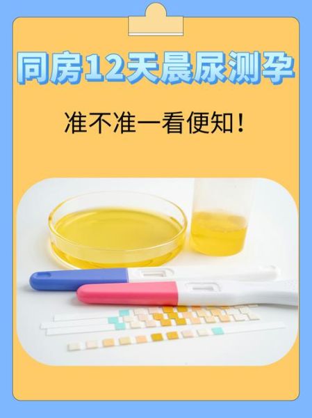 孕妇尿液有什么用_孕妇尿液检测能查什么-第1张图片-星辰妙记