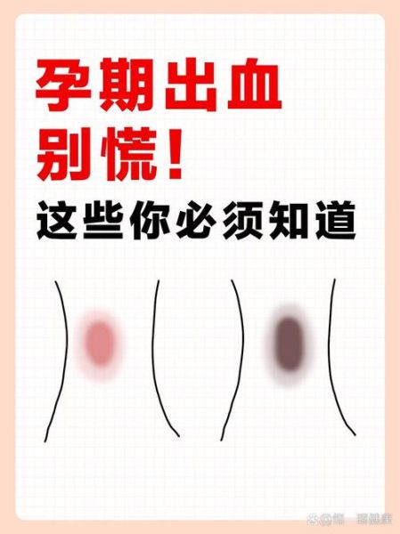 孕妇见红怎么办_见红后多久会生-第2张图片-星辰妙记
