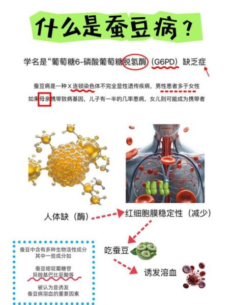 孕妇有蚕豆病怎么办_蚕豆病孕妇饮食禁忌-第2张图片-星辰妙记