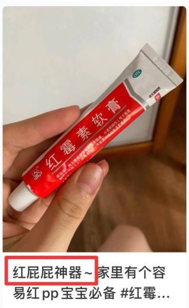 孕妇可以涂红霉素软膏吗_红霉素软膏对胎儿有影响吗-第3张图片-星辰妙记 孕妇可以涂红霉素软膏吗_红霉素软膏对胎儿有影响吗-第3张图片-星辰妙记