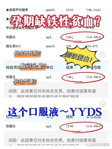 孕妇血清铁蛋白正常值是多少_低于多少算缺铁-第2张图片-星辰妙记