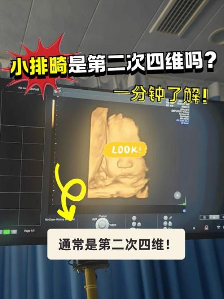 孕妇小排畸检查什么_小排畸几周做最合适-第2张图片-星辰妙记