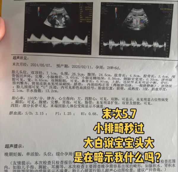 孕妇小排畸检查什么_小排畸几周做最合适-第3张图片-星辰妙记
