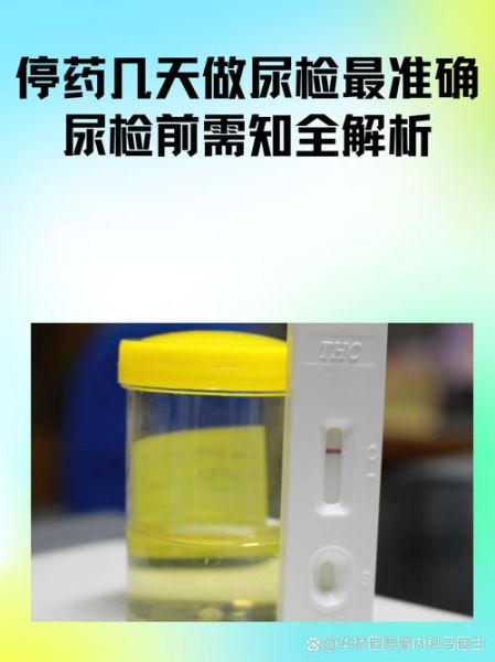 孕妇尿检什么时候做_孕妇尿检能查出什么-第2张图片-星辰妙记