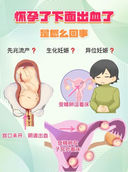 孕妇下面出血怎么回事_孕早期出血正常吗-第3张图片-星辰妙记