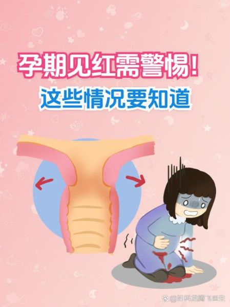 孕妇梦见内裤有血是什么意思_孕晚期见红梦境解析-第3张图片-星辰妙记