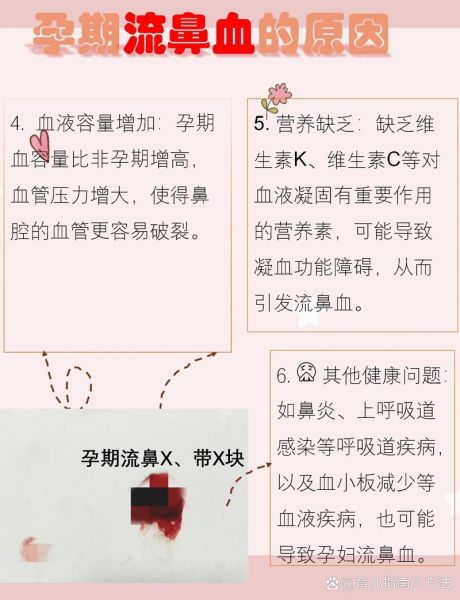 孕妇流鼻血是怎么回事_孕妇流鼻血正常吗-第1张图片-星辰妙记