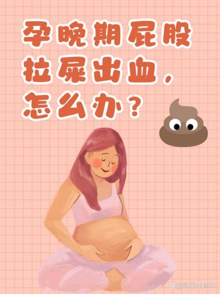 孕妇大便出血怎么办_孕妇便秘出血的原因-第3张图片-星辰妙记