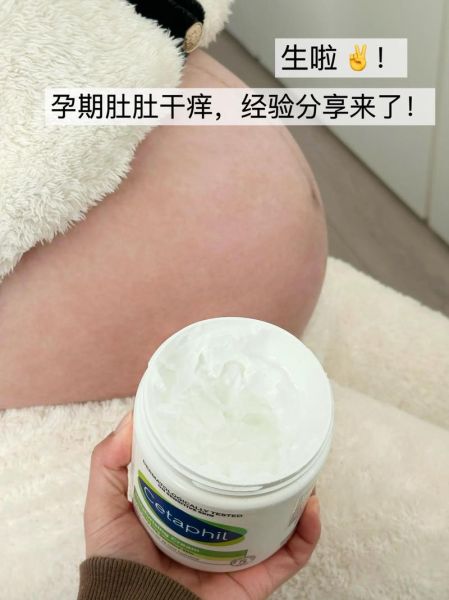 孕妇肚子痒怎么办_怀孕肚皮痒怎么缓解-第3张图片-星辰妙记