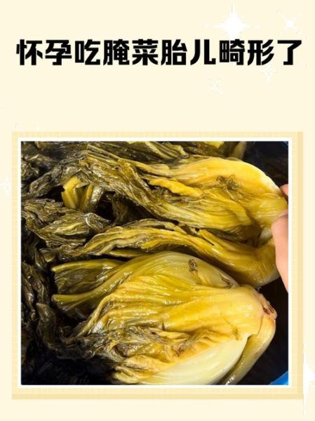 孕妇可以吃酸菜不_怀孕吃酸菜安全吗-第3张图片-星辰妙记 孕妇可以吃酸菜不_怀孕吃酸菜安全吗-第3张图片-星辰妙记