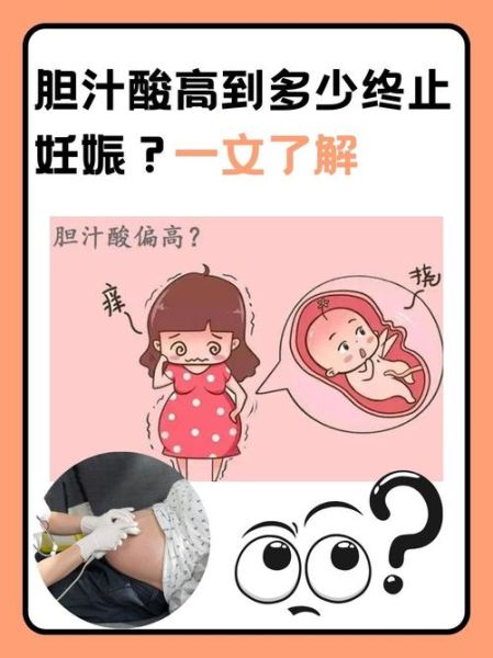 孕妇胆汁酸高有什么症状_胆汁酸偏高对胎儿影响-第2张图片-星辰妙记 孕妇胆汁酸高有什么症状_胆汁酸偏高对胎儿影响-第2张图片-星辰妙记